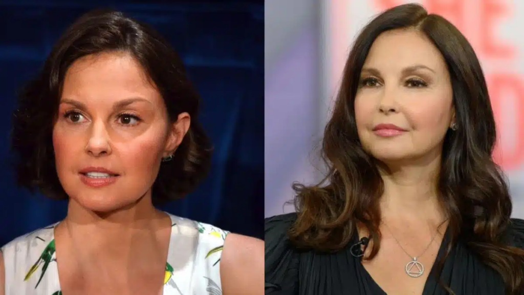 ashley judd plastic surgery